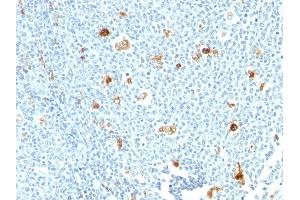 Formalin-fixed, paraffin-embedded human tonsil stained with Calprotectin Monoclonal Antibody (CPT/1028) (S100A9 antibody)