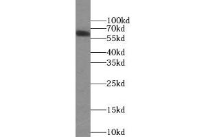 WB analysis of HepG2 cells subjected to SDS-PAGE, using PLAP antibody (1/1000 dilution).