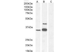 Western Blotting (WB) image for anti-WNT1 Inducible Signaling Pathway Protein 1 (WISP1) (C-Term) antibody (ABIN238610)
