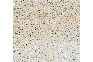 IHC analysis of FTO using anti-FTO antibody (ABIN7601059).