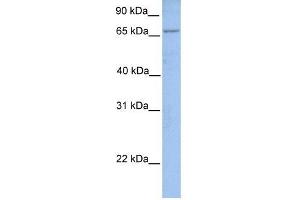 ACSL1 antibody used at 1 ug/ml to detect target protein. (ACSL1 antibody  (N-Term))