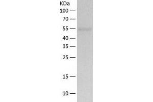 UGP2 Protein (AA 1-508) (His tag)