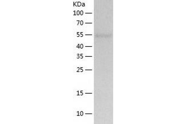 UGP2 Protein (AA 1-508) (His tag)