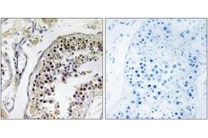 Immunohistochemistry analysis of paraffin-embedded human testis tissue, using CNOT4 Antibody. (CNOT4 antibody  (AA 61-110))