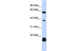 WB Suggested Anti-HTR3E Antibody Titration:  0. (HTR3E antibody  (Middle Region))