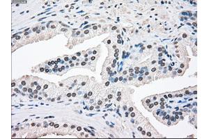 Immunohistochemical staining of paraffin-embedded Ovary tissue using anti-SSBmouse monoclonal antibody. (SSB antibody)