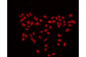 ABIN6267695 staining K562 by IF/ICC. (RPS6KB2 antibody  (pSer423))