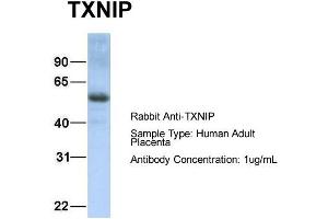 Host: Rabbit Target Name: TXNIP Sample Type: Human Adult Placenta Antibody Dilution: 1. (TXNIP antibody  (C-Term))