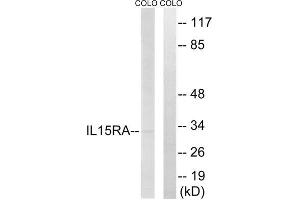 Western blot analysis of extracts from COLO cells, using IL15RA antibody. (IL15RA antibody  (Internal Region))