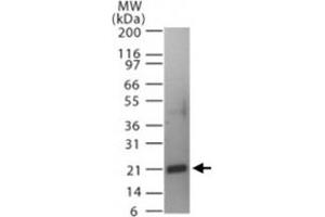Western blot analysis of Tnfsf11 in a partial His-tagged recombinant protein. (RANKL antibody  (AA 161-177))