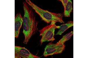 Immunofluorescence analysis of Hela cells using NEFL mouse mAb (green). (NEFL antibody)