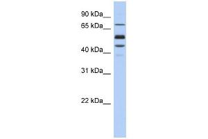 WB Suggested Anti-PROS1 Antibody Titration: 0. (PROS1 antibody  (Middle Region))