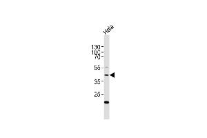 Anti-E2F1 Antibody at 1:2000 dilution + Hela whole cell lysates Lysates/proteins at 20 μg per lane. (E2F1 antibody  (AA 342-371))