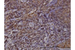 Immunostaining (ISt) image for anti-Sorting Nexin 1 (SNX1) (AA 166-275) antibody (ABIN562947)