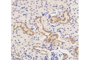 Immunohistochemistry analysis of paraffin-embedded mouse kidney using,MRP6 (ABIN7073149) at dilution of 1: 2000 (ABCC6 antibody)