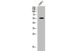 Western Blot analysis of 22RV1 cells using CYP2A7 Polyclonal Antibody (CYP2A7 antibody  (C-Term))