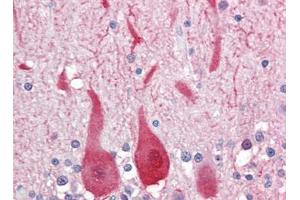 Human Brain, Cerebellum (formalin-fixed, paraffin-embedded) stained with ALDOCfollowed by biotinylated goat anti-rabbit IgG secondary antibody, alkaline phosphatase-streptavidin and chromogen. (ALDOC antibody  (C-Term))