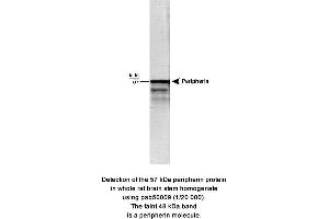 Image no. 1 for anti-Peripherin (PRPH) (full length) antibody (ABIN363318) (Peripherin antibody  (full length))