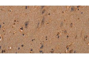 Immunohistochemistry of paraffin-embedded Human brain tissue using COL18A1 Polyclonal Antibody at dilution 1:40 (COL18A1 antibody)