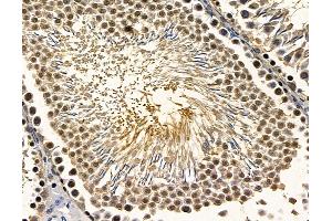 ABIN7096863 and ABIN7100929 at 1/100 staining rat testis tissue by IHC-P. (RFX2 antibody)