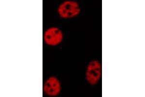 ABIN6272261 staining COLO205 by IF/ICC. (CEBPZ antibody  (N-Term))