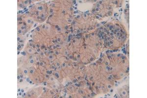 Figure. (ERN1 antibody  (AA 571-832))