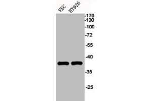 Western Blot analysis of VEC HY926 cells using EKLF/CKLF/UKLF Polyclonal Antibody (KLF1/5/7 antibody  (C-Term))