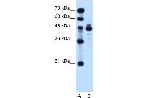 WB Suggested Anti-IHH Antibody Titration:  1.