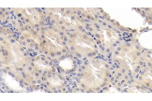 Detection of CDK2AP1 in Human Kidney Tissue using Polyclonal Antibody to Cyclin Dependent Kinase 2 Associated Protein 1 (CDK2AP1) (CDK2AP1 antibody  (AA 1-115))