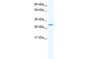 SPIC antibody (20R-1185) used at 5 ug/ml to detect target protein. (SPIC antibody  (N-Term))