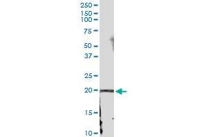 Immunoprecipitation of IFNA21 transfected lysate using anti-IFNA21 MaxPab rabbit polyclonal antibody and Protein A Magnetic Bead , and immunoblotted with IFNA21 MaxPab mouse polyclonal antibody (B01) . (IFNA21 antibody  (AA 1-189))