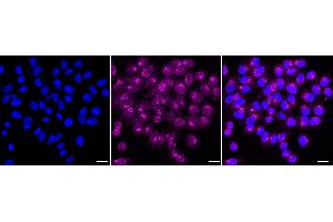 Immunocytochemical staining of HepG2 cells with DNPH1 antibody (ABIN7798082), 1:1,000).