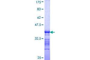 Thyroglobulin Protein (TG) (AA 2671-2768) (GST tag)