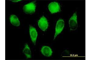 Immunofluorescence of purified MaxPab antibody to CYB5R3 on HeLa cell. (CYB5R3 antibody  (AA 1-301))