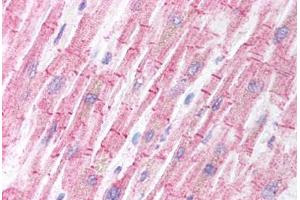 Human Heart (formalin-fixed, paraffin-embedded) stained with BCL2L11 antibody ABIN213909 at 5 ug/ml followed by biotinylated goat anti-rabbit IgG secondary antibody ABIN481713, alkaline phosphatase-streptavidin and chromogen. (BIM antibody  (Internal Region))