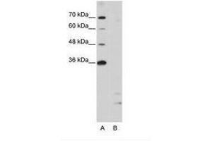 Image no. 1 for anti-Peptidylprolyl Isomerase E (Cyclophilin E) (PPIE) (AA 191-240) antibody (ABIN203035) (PPIE antibody  (AA 191-240))