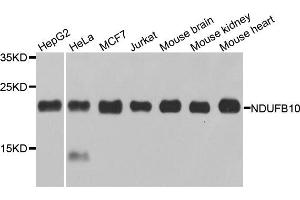 Western blot analysis of extracts of various cell lines, using NDUFB10 antibody.