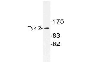 Western blot (WB) analysis of Tyk 2 antibody in extracts from 293cells.