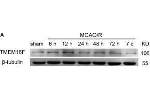 TMEM16F protein level increases after ischemic insult. (Anoctamin 6 antibody  (AA 744-824))