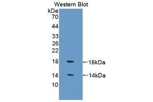 Detection of Recombinant FABP4, Chicken using Polyclonal Antibody to Fatty Acid Binding Protein 4 (FABP4) (FABP4 antibody  (AA 1-125))