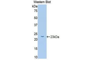 Western Blotting (WB) image for anti-Glucokinase (Hexokinase 4) Regulator (GCKR) (AA 90-286) antibody (ABIN1078068)