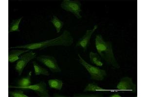 Immunofluorescence of purified MaxPab antibody to PPP6C on HeLa cell. (PPP6C antibody  (AA 1-305))