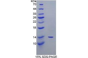 SDS-PAGE (SDS) image for Prostaglandin-Endoperoxide Synthase 2 (Prostaglandin G/H Synthase and Cyclooxygenase) (PTGS2) (AA 240-351) protein (His tag) (ABIN1080577)