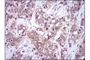 Immunohistochemistry (IHC) image for anti-Ubiquitin-Conjugating Enzyme E2I (UBE2I) antibody (ABIN969451)