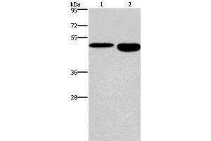 Western Blot analysis of Mouse stomach and brain tissue using DMRT3 Polyclonal Antibody at dilution of 1:550 (DMRT3 antibody)