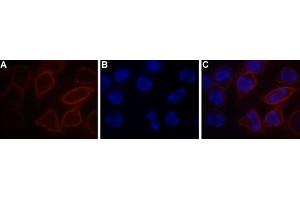 Expression of STIM1 in RBL cells - Cell surface detection of STIM1 in live RBL cells. (STIM1 antibody  (Extracellular, N-Term) (Atto 550))