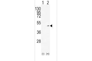 Western blot analysis of ADH1C (arrow) using rabbit polyclonal ADH1C Antibody (Center) (ABIN651725 and ABIN2840376). (ADH1C antibody  (AA 231-260))