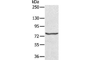 Western blot analysis of Hela cell, using MX1 Polyclonal Antibody at dilution of 1:200