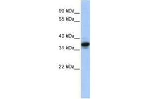Image no. 1 for anti-Mucin 3B, Cell Surface Associated (MUC3B) (AA 36-85) antibody (ABIN6744267) (MUC3B antibody  (AA 36-85))