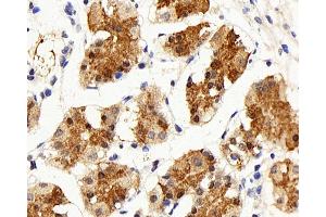 Immunohistochemistry analysis of paraffin-embedded human stomach using IL22RA1 Polyclonal Antibody at dilution of 1:200. (IL22 Receptor alpha 1 antibody)